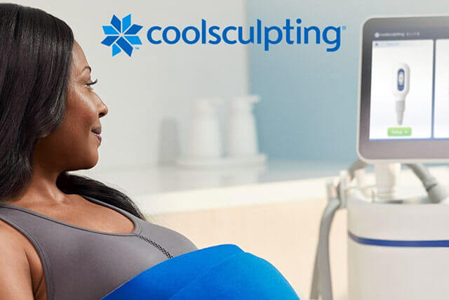 Having Coolsculpting