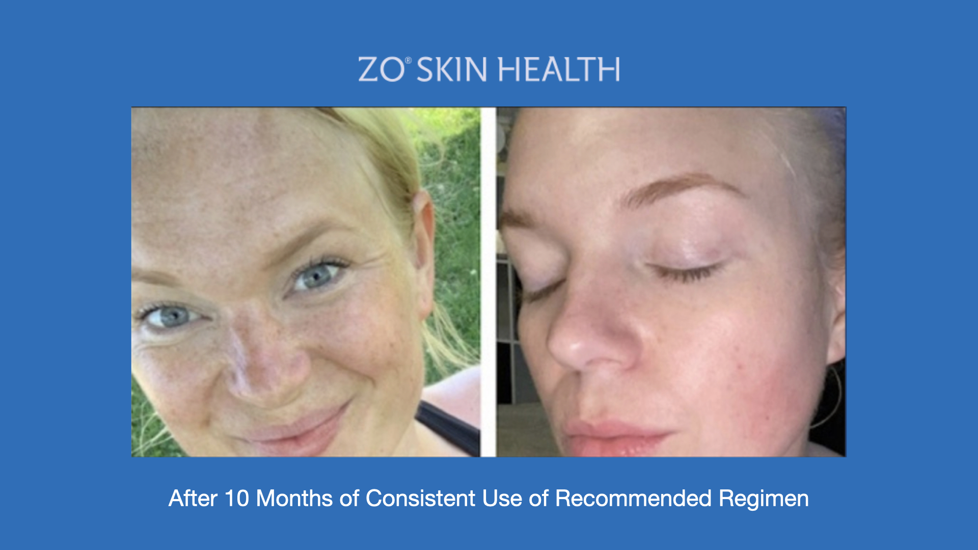 ADV Med Spa Services Video ZO® Professional Skin Care