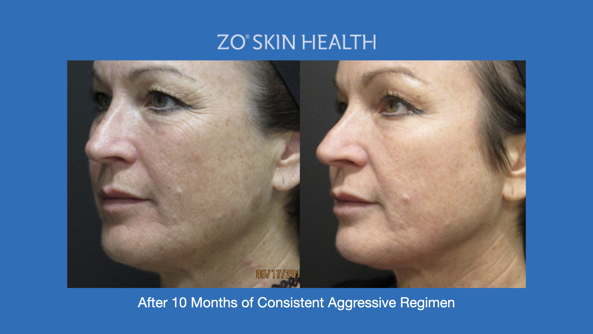 ADV Med Spa Services Video ZO® Professional Skin Care